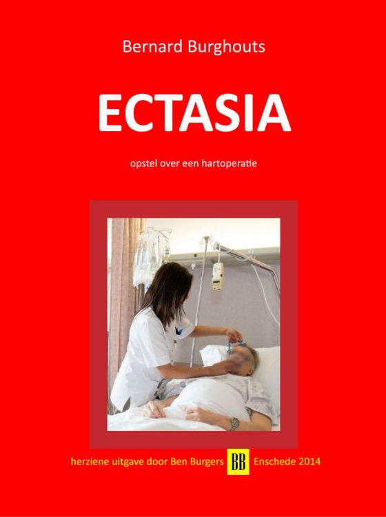 Ectasia epub